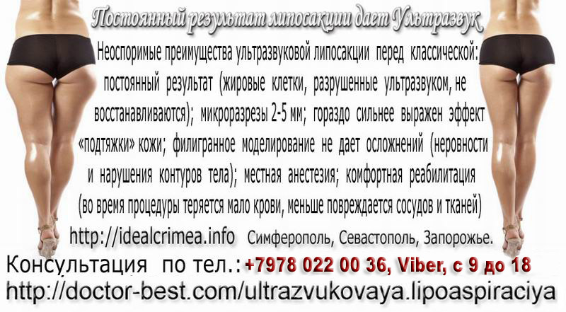 Ультразвуковая липосакция. Красивое тело всем к лицу!   - <ro>Изображение</ro><ru>Изображение</ru> #1, <ru>Объявление</ru> #43576