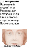 Молодость взгляду вернет пластика век!   - <ro>Изображение</ro><ru>Изображение</ru> #2, <ru>Объявление</ru> #20554