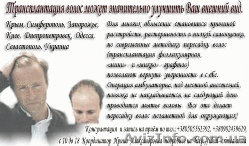 Пересадка волос. Трансплантация собственных волос - <ro>Изображение</ro><ru>Изображение</ru> #1, <ru>Объявление</ru> #8486