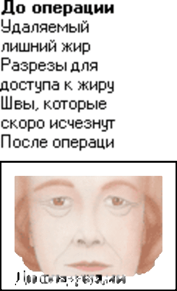 Молодость взгляду вернет пластика век!   - <ro>Изображение</ro><ru>Изображение</ru> #2, <ru>Объявление</ru> #20554